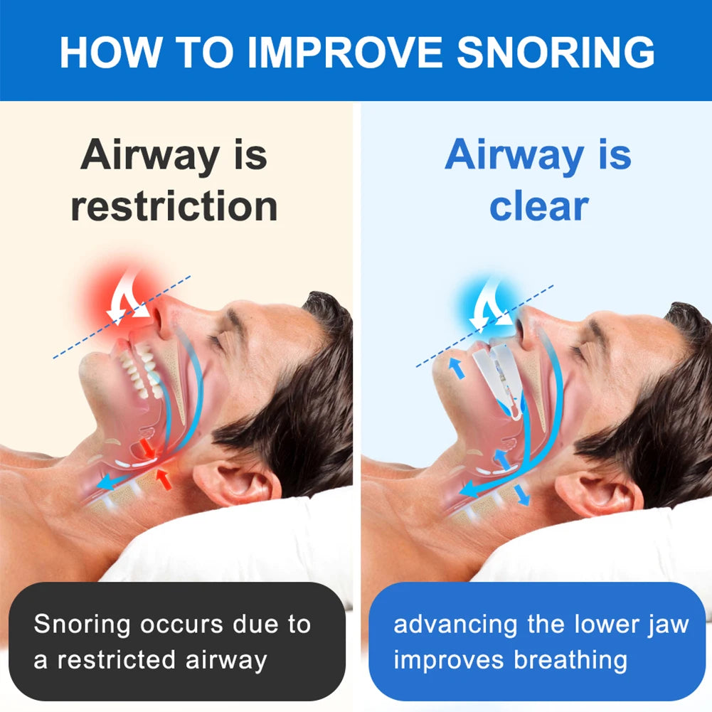 Anti-Snoring Mouthpiece Anti-Snoring Device Adjustable Jaw Positioning Night Time Teeth Mouthguard & Sleeping Bite Guard
