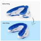 Anti-Snoring Mouthpiece Anti-Snoring Device Adjustable Jaw Positioning Night Time Teeth Mouthguard & Sleeping Bite Guard